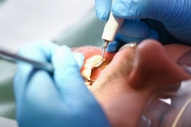 Best Mobile Emergency Dentist in Albion, IL