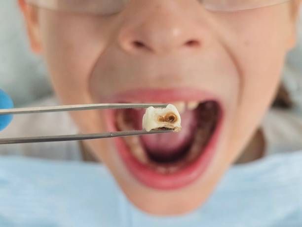 Best Emergency Cosmetic Dentistry in Albion, IL